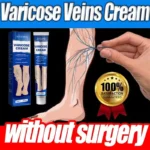 Ointment for Varicose Veins Eliminate Vasculitis Phlebitis to Relieve Spider Leg Pain Treatment Herbal cream - Image 3