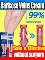 Ointment for Varicose Veins Eliminate Vasculitis Phlebitis to Relieve Spider Leg Pain Treatment Herbal cream - Image 2