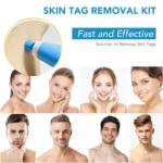 2 IN 1 Auto Micro Skin Tag Remover Device Standard And Micro Skin Tag Removal Kit Adult Mole Wart Remover Face Care Beauty Tools - Image 4