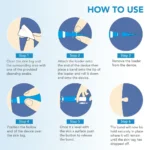 2 IN 1 Auto Micro Skin Tag Remover Device Standard And Micro Skin Tag Removal Kit Adult Mole Wart Remover Face Care Beauty Tools - Image 5