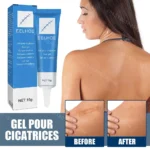 Recovery Scar Cream Fast Removal Skin Scars Treat Surgery Scars Stretch Marks Acne Pox Prints Burn Repair Facial Care Gel - Image 3