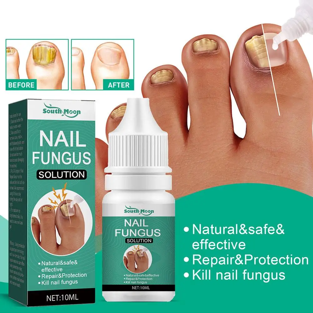 kf-Sce1f0fb8a4e44f7ebe795f8c3c0168d3Z Extra Strong Nail Fungus Treatment Serum Essence oil Repair Removal Fungal Feet Nails Care Toe Anti Infection Cream Essence O1T5 - Image 1