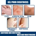 Recovery Scar Cream Fast Removal Skin Scars Treat Surgery Scars Stretch Marks Acne Pox Prints Burn Repair Facial Care Gel - Image 2